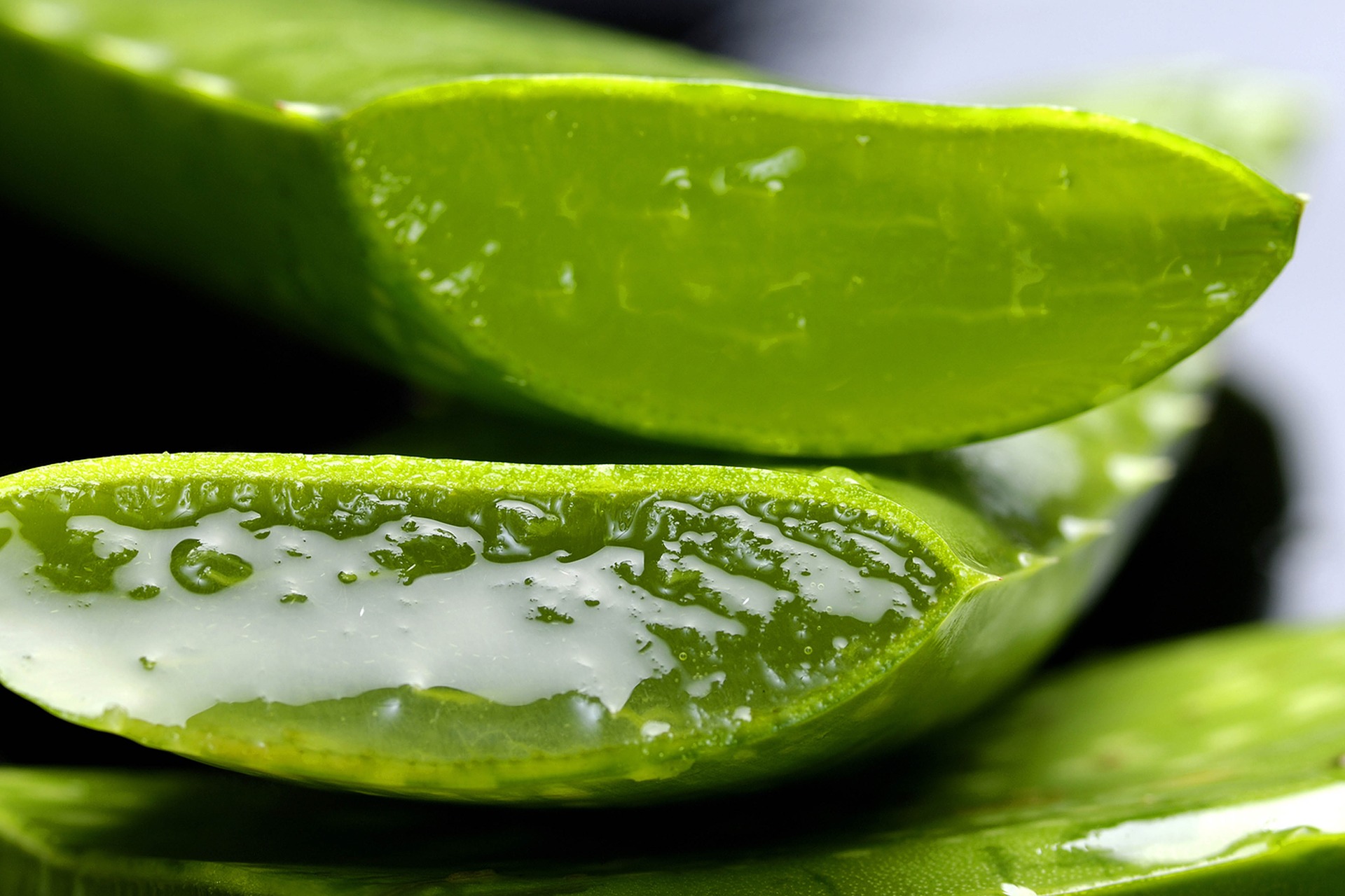 Aloe vera gel can help reduce dandruff symptoms