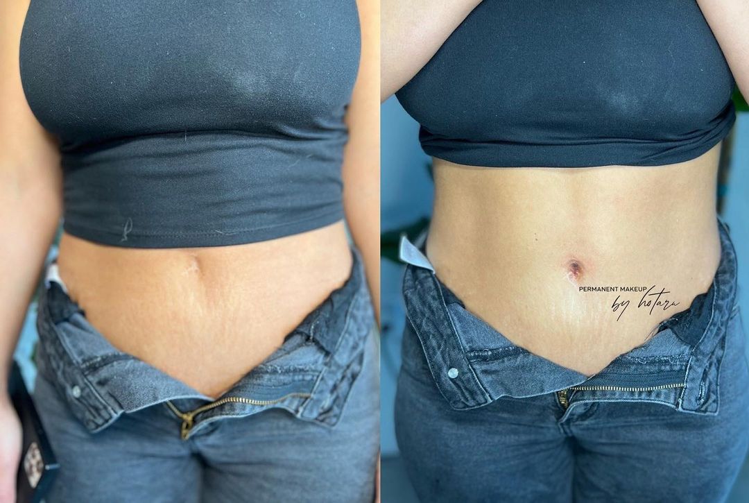 3D belly button recreation